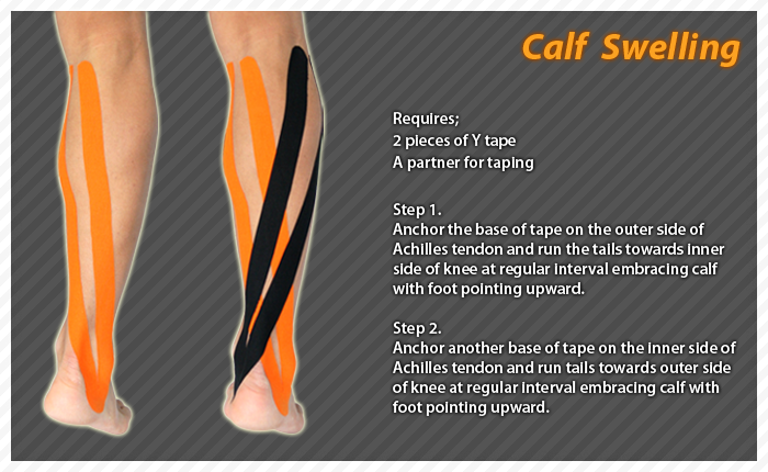 calf-pain-in-runners-9-causes-and-considerations-from-footwear-to-form